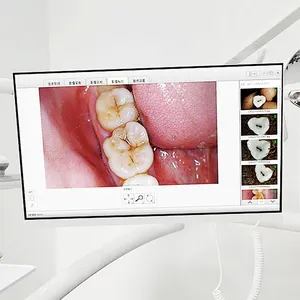 melhor câmera intraoral para odontologia, endoscópio dental, monitor intraoral, tudo em um