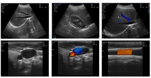 Alat Pemindai USG Nirkabel Genggam B26F 64 Kanal 192 Elemen 3 in 1 <span class=keywords><strong>Probe</strong></span> USG Jantung, Konveks, dan Vaskular - Product Image 2