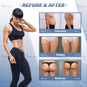 4 Başlıklı Elektromanyetik Kas Stimülasyonu EMS Zero Makinesi Fiyatı 14 Tesla 5000W Yüksek Güçlü EMS Neo Cihazı Satılık - Product Image 6