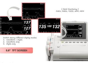 Appareil ECG médical Edan F2, Doppler fœtal simple ou double Edan pour usage vétérinaire - Product Image 3