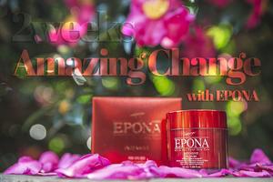 Crema de Aceite de Caballo Epona con Ácido Hialurónico, Crema Reparadora de la Barrera Cutánea para Piel Sensible y Dañada, Tratamiento Calmante - Product Image 4