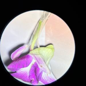 קולפוסקופ גניקולוגי kn 2200bi נייד סינקולוגי-קולפוסקופ ג 'ינאקולוגי לבדיקת הנרתיק - Product Image 2