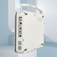 Valid CE SONOIMAGE Veterinary N20 Doppler Ultrasound Class II Medical Instrument Ensures Precise Diagnostic Imaging on Farms