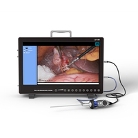 Système d'endoscopie HD portable tout-en-un YKD-9122 pour les procédures ORL Source d'alimentation électrique