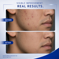 Crème hydratante pour le visage au rétinol et au tripeptide de cuivre, soin raffermissant pour jeunesse, 100 ml, marque privée, pour peaux mixtes, hommes
