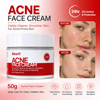 Crème de traitement des boutons Akaril 50g au beurre de karité, curcuma et arbutine – Anti-rides, éclaircissante, contrôle du sébum, texture lisse, exfoliante