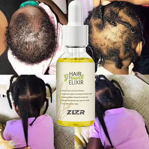 แชมพูบำรุงรากผมสูตรควบคุมความมัน ป้องกันผมร่วง บำรุงเส้นผมให้แข็งแรง ด้วยสารสกัดจากโสม สำหรับผู้ชายและผู้หญิง - Product Image 1