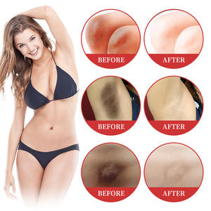 OEM/ODM Herbal Body Light ening Cream Achsel Oberschenkel Inner Knee Melanin Entsalzung und Entfernung zur Haut aufhellung Feuchtigkeit spendend - Product Image 3