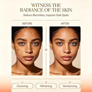 Savon au Miel de Manuka Éclaircissant Rapide en Gros 200g, Fait Main à l'Huile de Coco, Éclaircissant pour Peaux Foncées, Visage et Corps, Savon Solide au Miel - Product Image 4