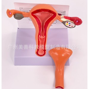 Modèle utérin pathologique féminin ; structure anatomique de l'ovaire et de l'utérus en obstétrique et gynécologie ; avancé - Product Image 4