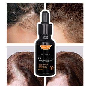 Olio di Batana olio di rosmarino crescita dei capelli fieno greco cura <span class=keywords><strong>essentia</strong></span> olio per capelli - Product Image 1