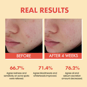 Siero Viso Anti-Età e Anti-Rughe Biologico Coreano con Etichetta Privata, Vitamina C e Retinale, Olio Riparatore per la Cura della Pelle, Prodotti Naturali per la Skincare - Product Image 5