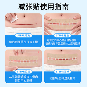 Parche de Alivio de Tensión Chen Kang, Dispositivo Médico Impermeable Tipo Cremallera Sin Suturas para Cierre de Piel y Cuidado de Heridas - Product Image 3