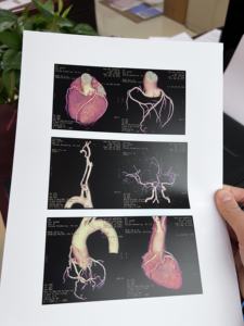 निर्माताओं प्रत्यक्ष बिक्री सफेद Inkjet चिकित्सा फिल्म चिकित्सा छवि उत्पादन सीटी के लिए एक्स-रे सीटी एमआरआई पालतू-सीटी - Product Image 4