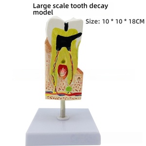 4X modèle de développement de caries dentaires en PVC agrandi pour l'éducation des patients et l'outil de formation dentaire - Product Image 2