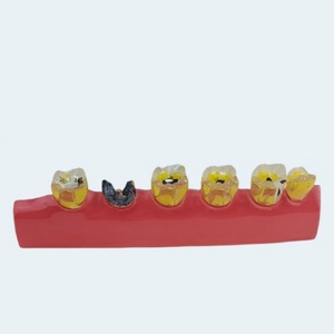 แบบจำลองฟันผุมาตรฐานทางทันตกรรม พร้อมแหล่งจ่ายไฟแบบแมนนวล สำหรับอุปกรณ์บำบัดช่องปาก อุปกรณ์เสริมสำหรับการสอนโรคฟันปลอม แบบจำลองฟัน - Product Image 5