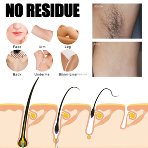 Bandes de cire dépilatoire en tissu non tissé naturel, <span class=keywords><strong>prix</strong></span> de vente en gros, 18*9 cm, pas besoin de chauffe-cire, bandes de cire prêtes à l'emploi - Product Image 4