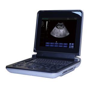 Escáner de Ultrasonido Veterinario Portátil Pu Vdl121a con Batería Integrada para Uso Médico - Product Image 2