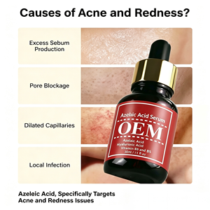 Sérum Visage OEM à l'Acide Azé<span class=keywords><strong>la</strong></span>ïque – Contrôle du Sébum, Anti-Imperfections, Soin Doux pour <span class=keywords><strong>la</strong></span> <span class=keywords><strong>Peau</strong></span>, Estompe les Marques <span class=keywords><strong>et</strong></span> Taches Post-Acné, Apaise <span class=keywords><strong>et</strong></span> Répare les Rougeurs - Product Image 1