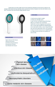 Hot Sale Haushalts medizin für Vitiligo Psoriasis Behandlung Psoriasis Behandlung Vitiligo Behandlung Heilung Handheld - Product Image 4