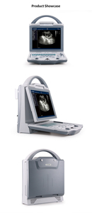 Equipo de Ultrasonido Médico en Blanco y Negro, <span class=keywords><strong>Precio</strong></span> de Máquina de Ultrasonido Portátil, Escáner Veterinario - Product Image 6