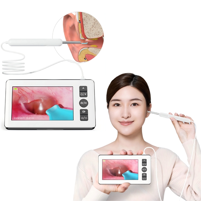 Screen Visual Ear Wax Removal with 4.3 Inch Screen 3.5mm Camera Digital Otoscope Endoscope Visible Ear Picker Cleaner Remover