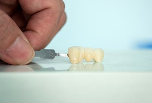 Materiali dentali di alta qualità materiale sanitario ceramico dischi di zirconio dentale blocco prezzo 3D pro zirconia blocco - Product Image 6