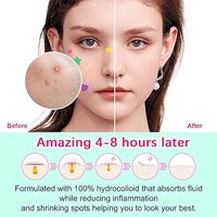 Meilleure vente d'usine de patch pour bouton d'acné meilleur pour zits points blancs imperfections patch d'acné étoile arc-en-ciel