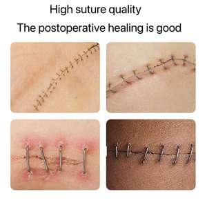 Grapadora de Piel Portátil y Eficiente de Venta Caliente para Cirugía y Tratamientos de Emergencia, Operada Manualmente, Marca JOY, Modelo 25R, Clase II - Product Image 5