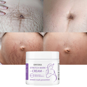 Crema per la rimozione della cicatrice dell'acne con etichetta privata brufoli smagliature rimuovono la crema per la rimozione delle smagliature in Gel per il viso - Product Image 6