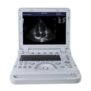 CONTEC CMS1700B Machine à ultrasons <span class=keywords><strong>4d</strong></span> d'occasion - Product Image 2