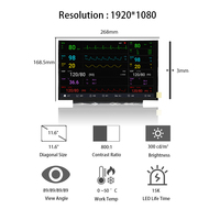 Panel LCD AUO 11.6" 1920X1080 FHD G116HAN01.0 Layar Resolusi Tinggi Modul LCD 11.6 Inci