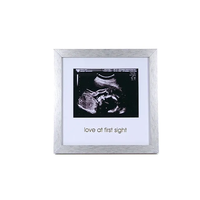 Zwangerschap Miskraam Verlies Fairy Scan Fotolijst Miskraam Ultrasound Frame