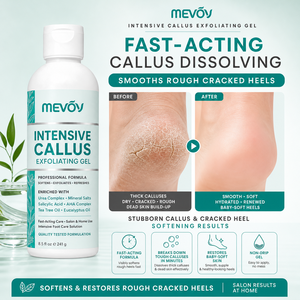 Gel Rimuovi Calli Extra Forte OEM di Grado Professionale per Talloni Secchi e Screpolati, Rimozione <span class=keywords><strong>Pelle</strong></span> Morta, Pedicure da Salone per Piedi a Casa - Product Image 3