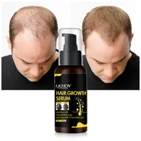 Tratamiento de caída de cabello con fórmula 100% natural, logo personalizado, el mejor suero para el crecimiento del cabello de argán