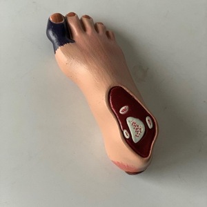 Modelo Anatómico de Patología de Diabetes Humana, Modelo de Enseñanza de 8 Partes, Modelo de Anatomía del Páncreas de Alta Calidad - Product Image 6