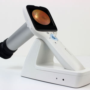 Çin ucuz taşınabilir olmayan midriatik <span class=keywords><strong>Retinal</strong></span> kamera fiyat Optomed el mobil Fundus kamera - Product Image 1