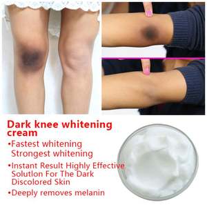 Crema blanqueadora para área privada, removedor de manchas oscuras, depigmento de parte íntima, brillo, crema para área de Bikini para mujeres, fábrica de cosméticos - Product Image 2