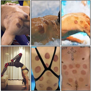 Promo Hijama Cuppign Grosir AS PS Ukuran 1-6 Terapi Vakum Medis Tradisional Tiongkok Hijama Cups Terapi Darah Basah - Product Image 6