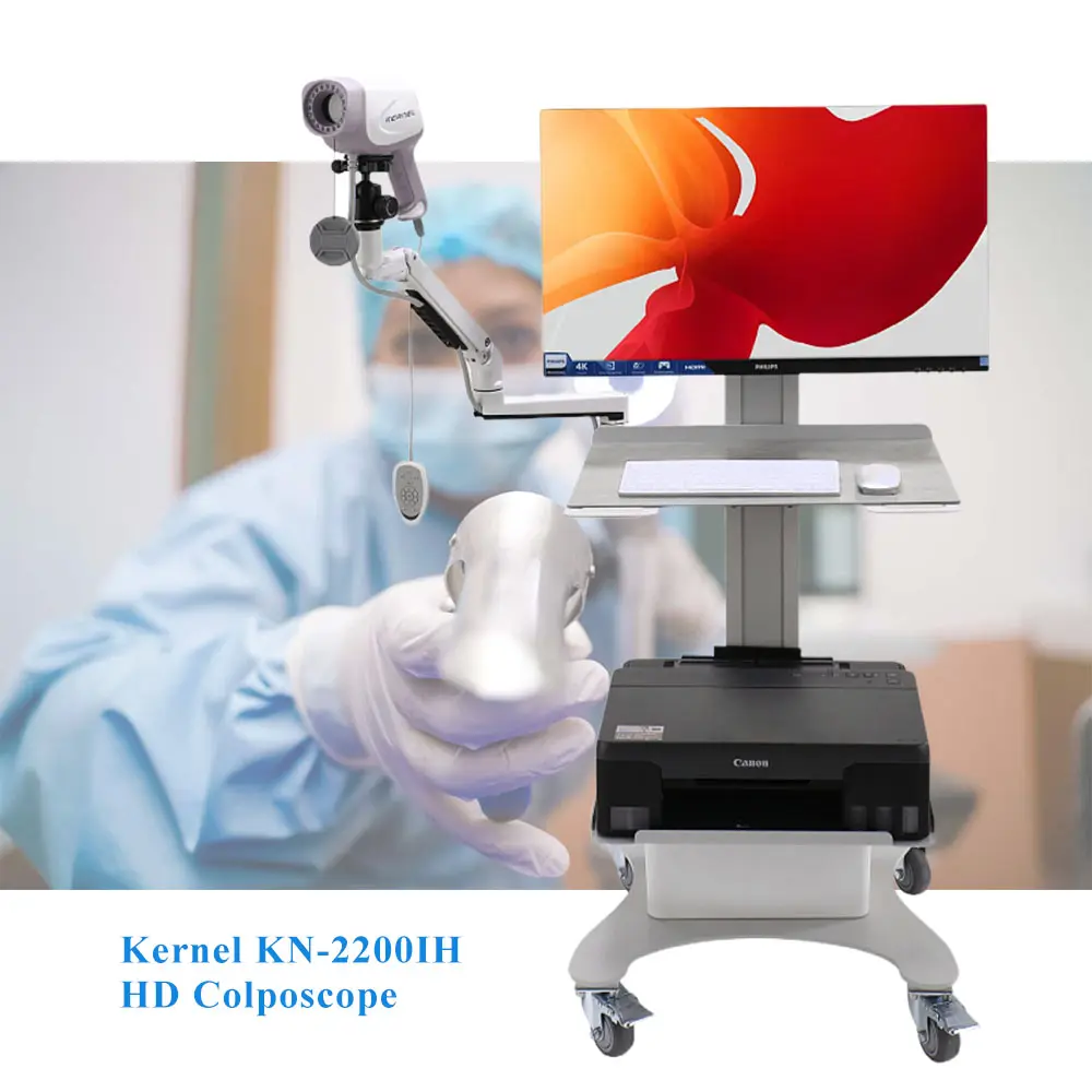 HD Video Colposcope digital colposcopy gynecology endoscope for cervical cancer and cervical screening