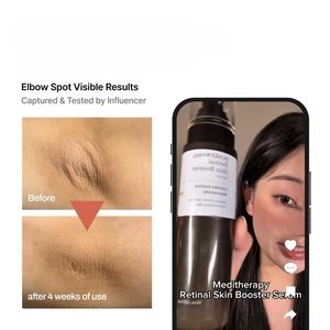 Suero Renovador de Piel con Retinaldehído, Niacinamida Antienvejecimiento con Ácido Hialurónico para el Cuidado Facial - Product Image 5