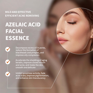 Serum Wajah Anti Penuaan, produk perawatan kulit Anti jerawat, Serum menyusutkan pori-pori, - Product Image 4