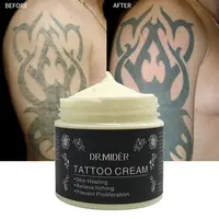 Oem/odm Фирменная торговая марка, натуральное средство для удаления татуировок, новые технологические продукты, крем для удаления татуировок после ухода
