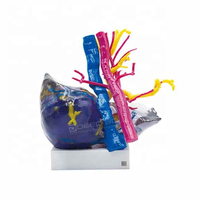 Custom Medical Models Stratasys PolyJet Color 3D Printing Service for Preoperative Planning and Teaching Displays