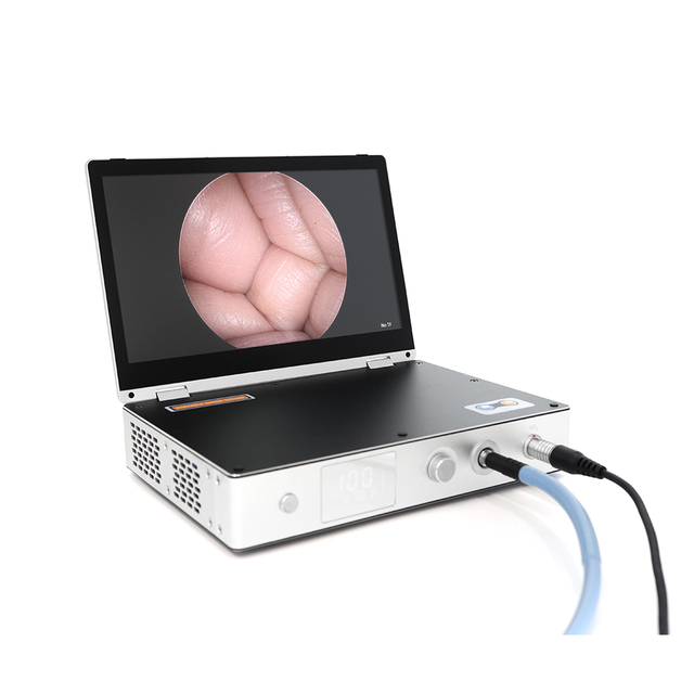 Medical Equipment 11.6 Inch Screen 4 in 1 Camera System for Endoscopy Surgery with LED Light Source Video Recording