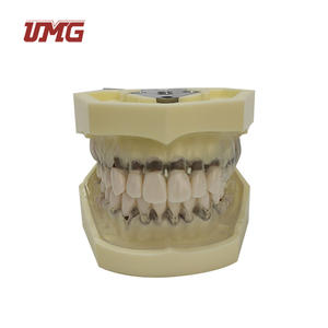 Model penyakit periodalat-alat dengan transparan demografis permen karet vagina ginives - Product Image 4