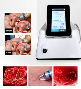 Appareil de physiothérapie laser pour les mycoses vasculaires <span class=keywords><strong>et</strong></span> des ongles, traitement laser des varices en clinique, technologie laser diode - Product Image 4