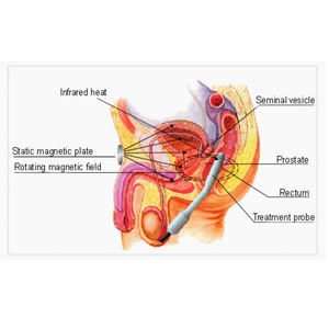Dispositivo de terapia de próstata multiefecto <span class=keywords><strong>para</strong></span> prostatitis y agrandamiento de próstata BPH - Product Image 3