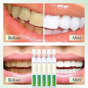 Essence personnalisée de blanchiment des dents multi-usages Nouvelle formule pour éliminer le jaunissement Acide des fruits frais pour une bouche propre - Product Image 2
