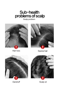 Trichoscope de Bureau Intelligent pour l'Analyse du Cuir Chevelu et la Détection des Cheveux, Caméra IA HD pour l'Examen des Follicules Pileux - Product Image 5